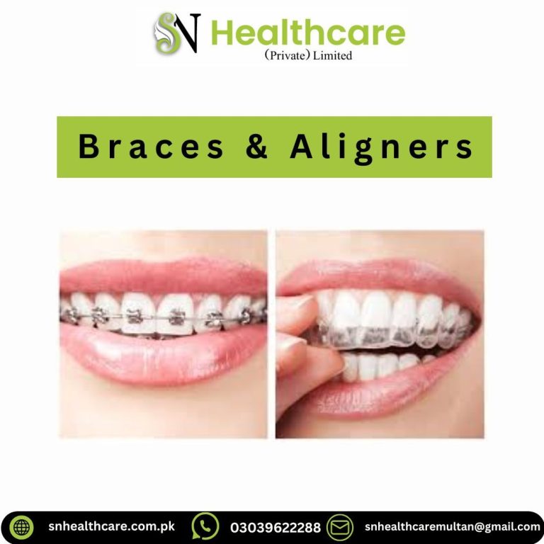 Invisible Teeth Aligners vs Metal Braces | SN Healthcare Multan
